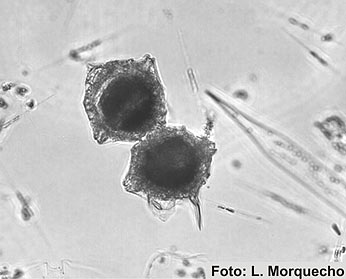 Foto de Pyrodinium bahamense Foto de Pyrodinium bahamense