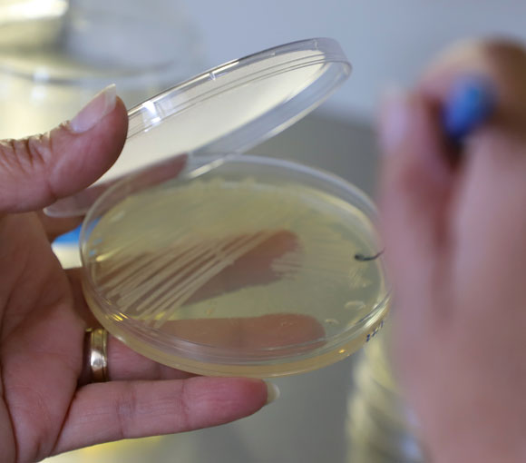 Microbiológico